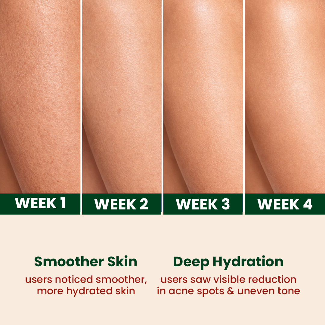 Acne Control & Hydration Duo | Ayurvedic Face Cleanser for Acne Skin