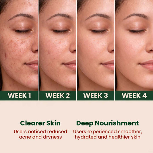 Oil Control & Acne-Prone Moringa Face Wash